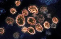 Biến thể của virus SARS-CoV-2 phát hiện ở Anh gây tử vong cao hơn từ 30% - 100%