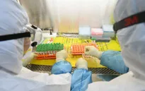 Pháp phát hiện biến chủng mới của SARS-CoV-2 cho kết quả âm tính