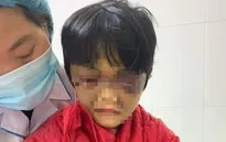 Bé gái 6 tuổi bị mẹ đẻ bạo hành thâm tím mặt