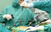 Phát hiện ung thư cổ tử cung sau thời gian ra máu âm đạo bất thường