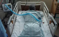 Nghiên cứu mới: Di chứng COVID-19 có thể kéo dài một năm