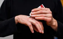 Cách kiểm soát da khô trong mùa đông