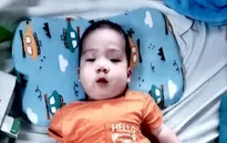 Em bé 1 tuổi ở Cà Mau phẫu thuật tim thành công, sắp ra viện