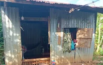 "Trái tim lỗi nhịp" ở Bình Phước cần được giúp đỡ