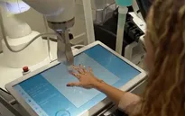 Robot siêu âm giúp phát hiện sớm bệnh viêm khớp