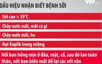 Bệnh sởi trở thành "mối đe dọa cận kề" trên toàn cầu
