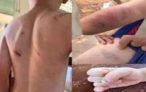 Vụ cháu bé 9 tuổi bị đánh đập ở Đắk Lắk: Khởi tố bà nội và cha ruột