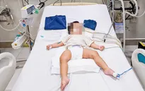 Sức khỏe bé 2 tuổi bị bạo hành ở Hà Nội chuyển biến khả quan sau 6 ngày được điều trị tích cực
