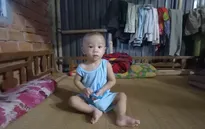 Người phụ hồ đau xót vì không có khả năng chi trả tiền phẫu thuật tim cho con