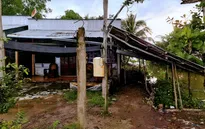 Bé trai 10 tháng tuổi ở Kiên Giang mắc bệnh tim bẩm sinh không có tiền phẫu thuật