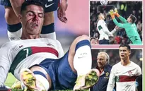 Ronaldo bị thủ môn đối phương đấm gãy mũi