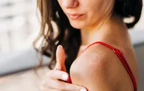 5 lý do khiến da bạn có thể bị bong tróc