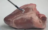Chữa bệnh bằng in 3D trong cơ thể người