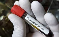 Mỹ phê duyệt vaccine đầu tiên trên thế giới ngừa virus Chikungunya