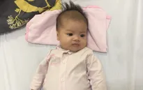Bé gái kháu khỉnh tại Hải Dương đã phẫu thuật tim thành công