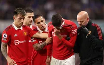 FA Cup | Man Utd tổn thất lực lượng trước thềm trận đấu với Brighton