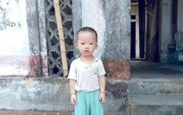 Cháu bé 1 tuổi mắc bệnh tim bẩm sinh đang rất cần sự giúp đỡ