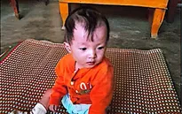Bệnh nhi 1 tuổi mắc bệnh tim bẩm sinh ở Lâm Đồng cần 180 triệu đồng để phẫu thuật