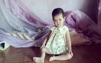 Xót xa với hoàn cảnh bệnh nhi 2 tuổi mắc tim bẩm sinh
