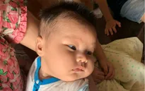 Bệnh nhi 3 tháng tuổi chênh vênh sự sống do căn bệnh tim bẩm sinh quái ác
