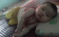 Mắc dị tật tim bẩm sinh, tính mạng cháu bé 7 tháng tuổi đang thoi thóp từng ngày