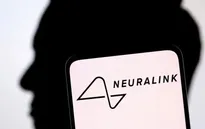 Người đầu tiên cấy chip Neuralink vào não có thể chơi game trên laptop bằng ý nghĩ