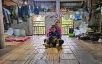 Bệnh nhi tim bẩm sinh 6 tuổi ở Hòa Bình đang rất cần sự chung tay giúp đỡ