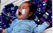 Cháu bé 7 tháng tuổi nguy kịch tính mạng vì bệnh tim bẩm sinh quái ác