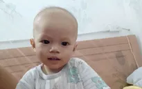 Cháu bé 2 tuổi ở Nghệ An mắc bệnh tim bẩm sinh không có tiền phẫu thuật