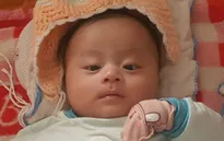 Cuộc chiến của cháu bé 1 tuổi với căn bệnh tim bẩm sinh quái ác