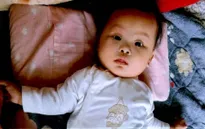 Niềm khát khao được phẫu thuật tim bẩm sinh của bệnh nhi 1 tuổi ở Hải Dương