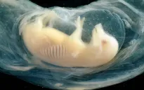 Lần đầu nuôi cấy thành công cấu trúc tim người đập suốt 21 ngày trong phôi lợn