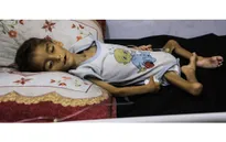 Liên hợp quốc: Khủng hoảng suy dinh dưỡng ở trẻ em Gaza chạm mức kỷ lục