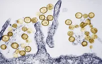 Số ca nhiễm hantavirus tăng mạnh ở Argentina