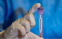 Quốc gia trải qua đợt bùng phát hantavirus kỷ lục 