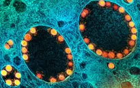 Mỹ lần đầu phê duyệt vaccine cúm mùa ứng dụng công nghệ mRNA