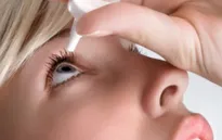 Không điều trị đau mắt đỏ kịp thời sẽ có biến chứng viêm giác mạc