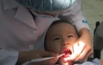 90% người Việt Nam gặp vấn đề răng miệng