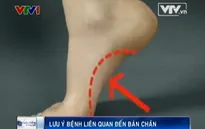 Lưu ý bệnh gai xương bàn chân