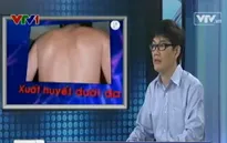 Sốc là biến chứng nặng trong sốt xuất huyết