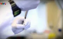 Tách virus HIV khỏi tế bào người