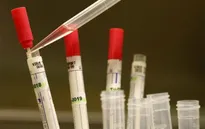 Cổ phiếu của các công ty sản xuất thuốc chữa Ebola tăng mạnh