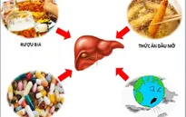 Cần phát hiện và điều trị sớm bệnh gan nhiễm mỡ