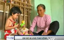 Xót thương bé 3 tuổi bị ung thư võng mạc