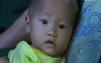 Bé H'mông 8 tháng mắc bệnh tim mong sự trợ giúp