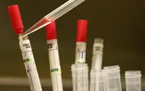 Mỹ gửi thuốc thử nghiệm điều trị Ebola tới Liberia