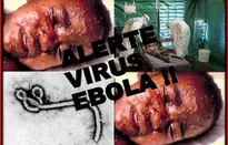 Đại dịch Ebola