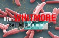 Bệnh Whitmore - "Sát thủ giấu mình"...