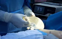 Bác sĩ Hồ Cao Vũ chia sẻ biến chứng tháo túi ngực