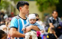 Gần 60 trẻ em được phẫu thuật khe hở môi - vòm miệng miễn phí